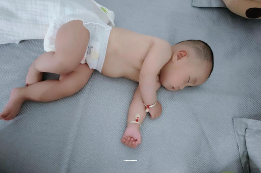 玉溪六个月宝宝眼睛散光